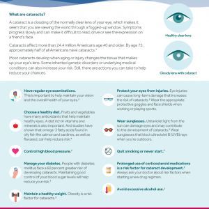 Infographic that discusses tips to reduce the risks of cataracts