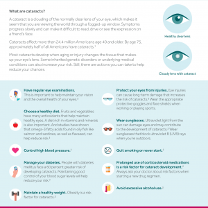 Infographic that discusses tips to reduce the risks of cataracts